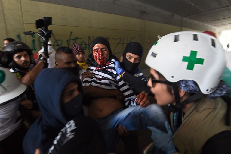 A wounded Venezuelan opposition activist is assisted by fellow demonstrators and volunteer medics during clashes with riot police during a protest in Caracas on July 10, 2017. Venezuela hit its 100th day of anti-government protests Sunday, amid uncertainty over whether the release from prison a day earlier of prominent political prisoner Leopoldo Lopez might open the way to negotiations to defuse the profound crisis gripping the country. / AFP PHOTO / JUAN BARRETO